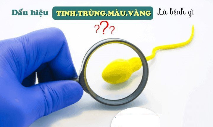 Không hiểu nguyên nhân tại sao tinh dịch có màu vàng?