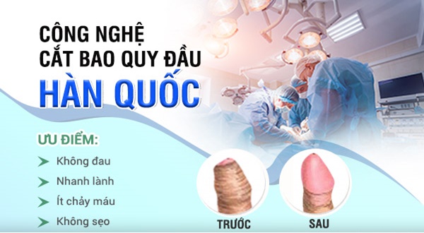 Cắt bao quy đầu có tốt không? Nên thực hiện ở đâu an toàn?